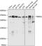 Polybromo 1 antibody, A01130, Boster Biological Technology, Western Blot image 
