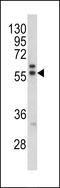 Melanoma antigen preferentially expressed in tumors antibody, 62-428, ProSci, Western Blot image 