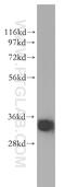 Sulfotransferase 1A3/1A4 antibody, 11376-1-AP, Proteintech Group, Western Blot image 