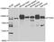 Receptor-type tyrosine-protein phosphatase epsilon antibody, STJ29289, St John