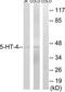 5-Hydroxytryptamine Receptor 4 antibody, TA314044, Origene, Western Blot image 