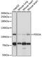 Phosphodiesterase 3A antibody, 18-159, ProSci, Western Blot image 