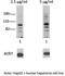 Aryl Hydrocarbon Receptor antibody, TA329363, Origene, Western Blot image 