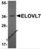 Elongation of very long chain fatty acids protein 7 antibody, 5641, ProSci, Western Blot image 