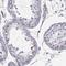 Ecto-NOX Disulfide-Thiol Exchanger 1 antibody, PA5-58355, Invitrogen Antibodies, Immunohistochemistry frozen image 