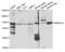 Bone Morphogenetic Protein Receptor Type 1A antibody, abx001501, Abbexa, Western Blot image 