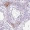 TAFA Chemokine Like Family Member 3 antibody, HPA055927, Atlas Antibodies, Immunohistochemistry frozen image 