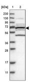 Plastin 3 antibody, PA5-54206, Invitrogen Antibodies, Western Blot image 
