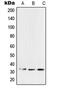 Pulmonary surfactant-associated protein A2 antibody, MBS821407, MyBioSource, Western Blot image 