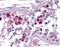SKA3 antibody, orb94328, Biorbyt, Immunohistochemistry paraffin image 