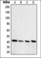 cAMP-dependent protein kinase type I-alpha regulatory subunit antibody, orb376093, Biorbyt, Western Blot image 