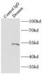 Desmin antibody, FNab02340, FineTest, Immunoprecipitation image 
