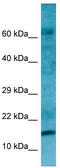 Ribosomal Protein L27a antibody, TA338354, Origene, Western Blot image 