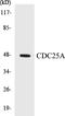 Cell Division Cycle 25A antibody, EKC1105, Boster Biological Technology, Western Blot image 