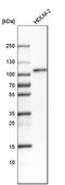 Ubiquitin Interaction Motif Containing 1 antibody, HPA037504, Atlas Antibodies, Western Blot image 