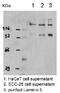 Laminin Subunit Beta 3 antibody, ab14509, Abcam, Western Blot image 
