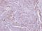 Zinc Finger DHHC-Type Containing 11 antibody, GTX106800, GeneTex, Immunohistochemistry paraffin image 