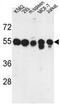 Protein phosphatase 1H antibody, GTX80567, GeneTex, Western Blot image 