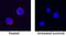 C-X-C Motif Chemokine Ligand 8 antibody, MAB1608, R&D Systems, Immunofluorescence image 