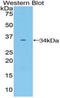 Frizzled Class Receptor 10 antibody, LS-C303530, Lifespan Biosciences, Western Blot image 