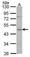 Origin Recognition Complex Subunit 4 antibody, GTX104684, GeneTex, Western Blot image 
