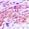 TRNA Methyltransferase 9B (Putative) antibody, LS-C668982, Lifespan Biosciences, Immunohistochemistry paraffin image 