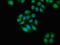Non-receptor tyrosine-protein kinase TYK2 antibody, LS-C682268, Lifespan Biosciences, Immunofluorescence image 