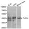 NPR2 Like, GATOR1 Complex Subunit antibody, LS-C334346, Lifespan Biosciences, Western Blot image 