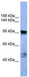 Adaptor Related Protein Complex 2 Subunit Alpha 2 antibody, TA342803, Origene, Western Blot image 
