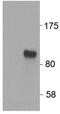 HIC ZBTB Transcriptional Repressor 1 antibody, PA5-37865, Invitrogen Antibodies, Western Blot image 