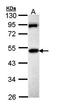 Ta antibody, orb15540, Biorbyt, Western Blot image 