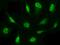 PSMB8 antibody, GTX02245, GeneTex, Immunofluorescence image 
