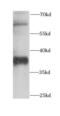 Protein canopy homolog 3 antibody, FNab01816, FineTest, Western Blot image 