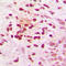 NCOR1 antibody, LS-C353192, Lifespan Biosciences, Immunohistochemistry paraffin image 