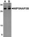 Nipsnap Homolog 3B antibody, MBS150995, MyBioSource, Western Blot image 