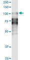 Desmocollin 2 antibody, LS-C197081, Lifespan Biosciences, Western Blot image 