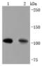 Complement component C3a antibody, NBP2-66994, Novus Biologicals, Western Blot image 