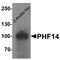 PHD Finger Protein 14 antibody, 7485, ProSci Inc, Western Blot image 