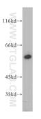 Dihydropyrimidinase antibody, 13237-1-AP, Proteintech Group, Western Blot image 