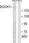 Dedicator of cytokinesis protein 1 antibody, TA313762, Origene, Western Blot image 