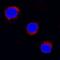 Suppressor Of Cytokine Signaling 5 antibody, AF4796, R&D Systems, Immunofluorescence image 