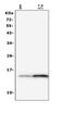 Fatty Acid Binding Protein 2 antibody, A02378, Boster Biological Technology, Western Blot image 