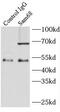 KH RNA Binding Domain Containing, Signal Transduction Associated 1 antibody, FNab07585, FineTest, Immunoprecipitation image 
