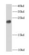 Chromobox 3 antibody, FNab01330, FineTest, Western Blot image 