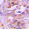 Protein NDRG2 antibody, LS-C356209, Lifespan Biosciences, Immunohistochemistry frozen image 