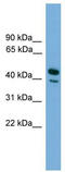 CD209 antigen antibody, TA329455, Origene, Western Blot image 