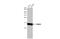 Neuraminidase antibody, GTX636968, GeneTex, Western Blot image 