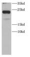 Caveolin 1 antibody, FNab01313, FineTest, Western Blot image 