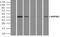 Mitogen-Activated Protein Kinase Kinase 4 antibody, NBP1-47839, Novus Biologicals, Immunoprecipitation image 