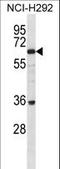 BTB Domain Containing 16 antibody, LS-C156879, Lifespan Biosciences, Western Blot image 